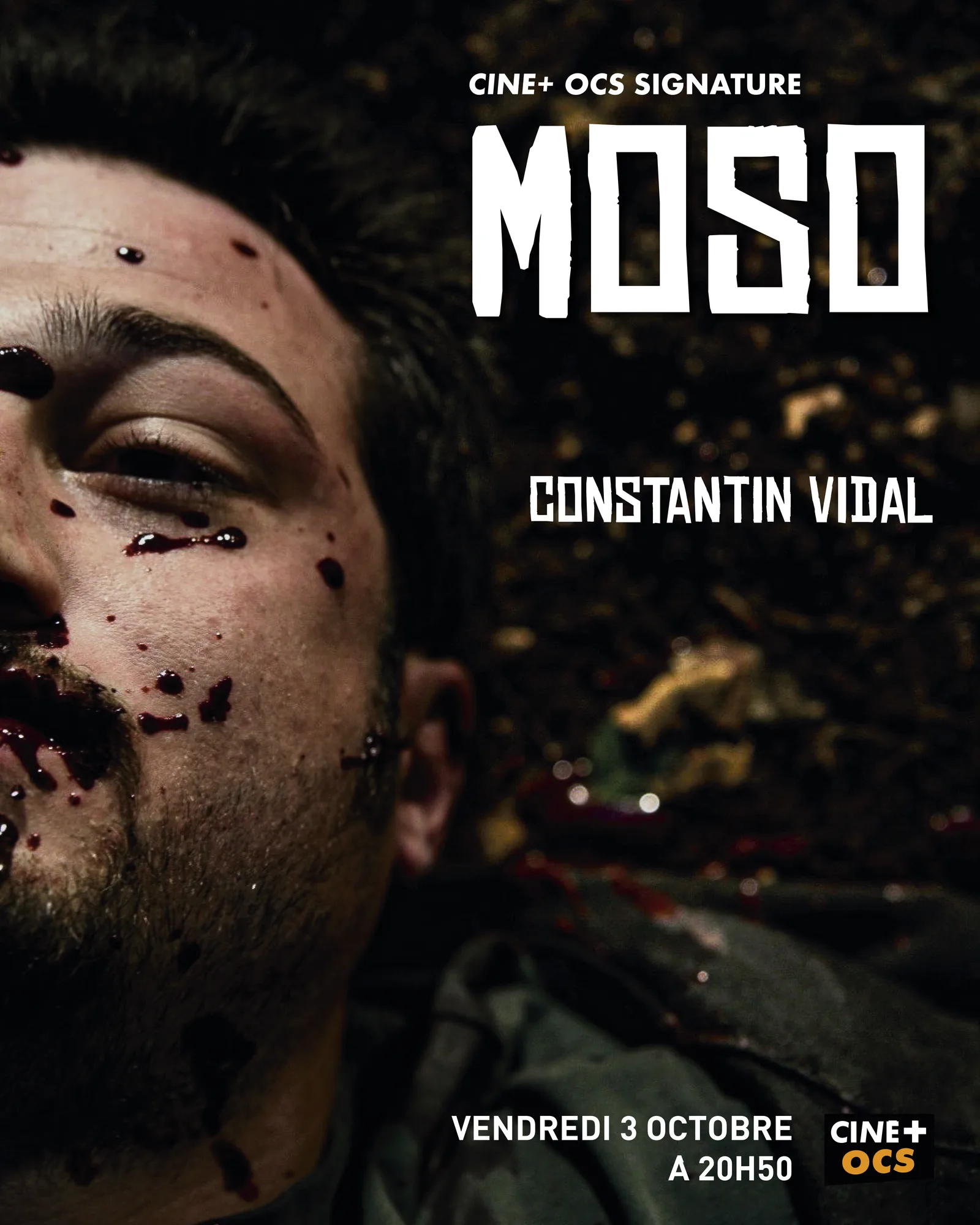 POST MOSO